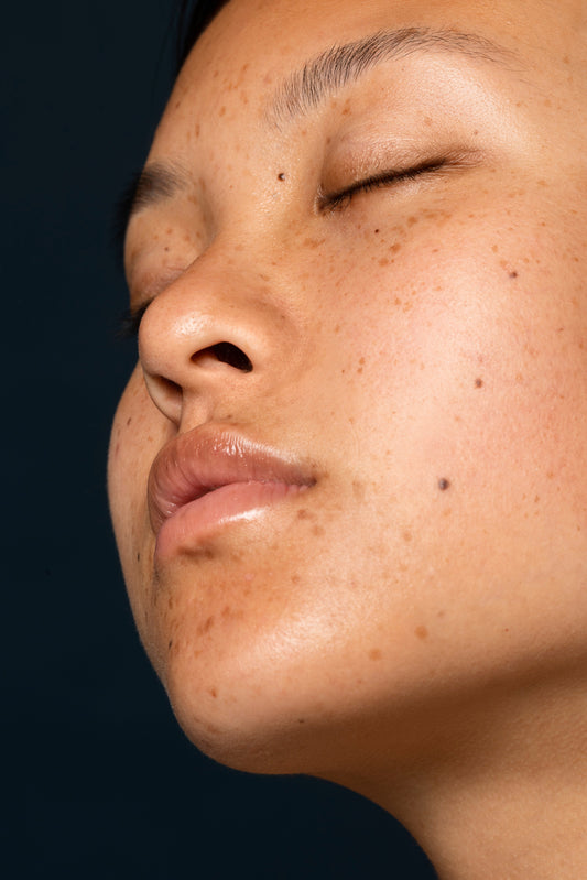 How to Transform Your Face with Dark Spots into a Radiant Complexion